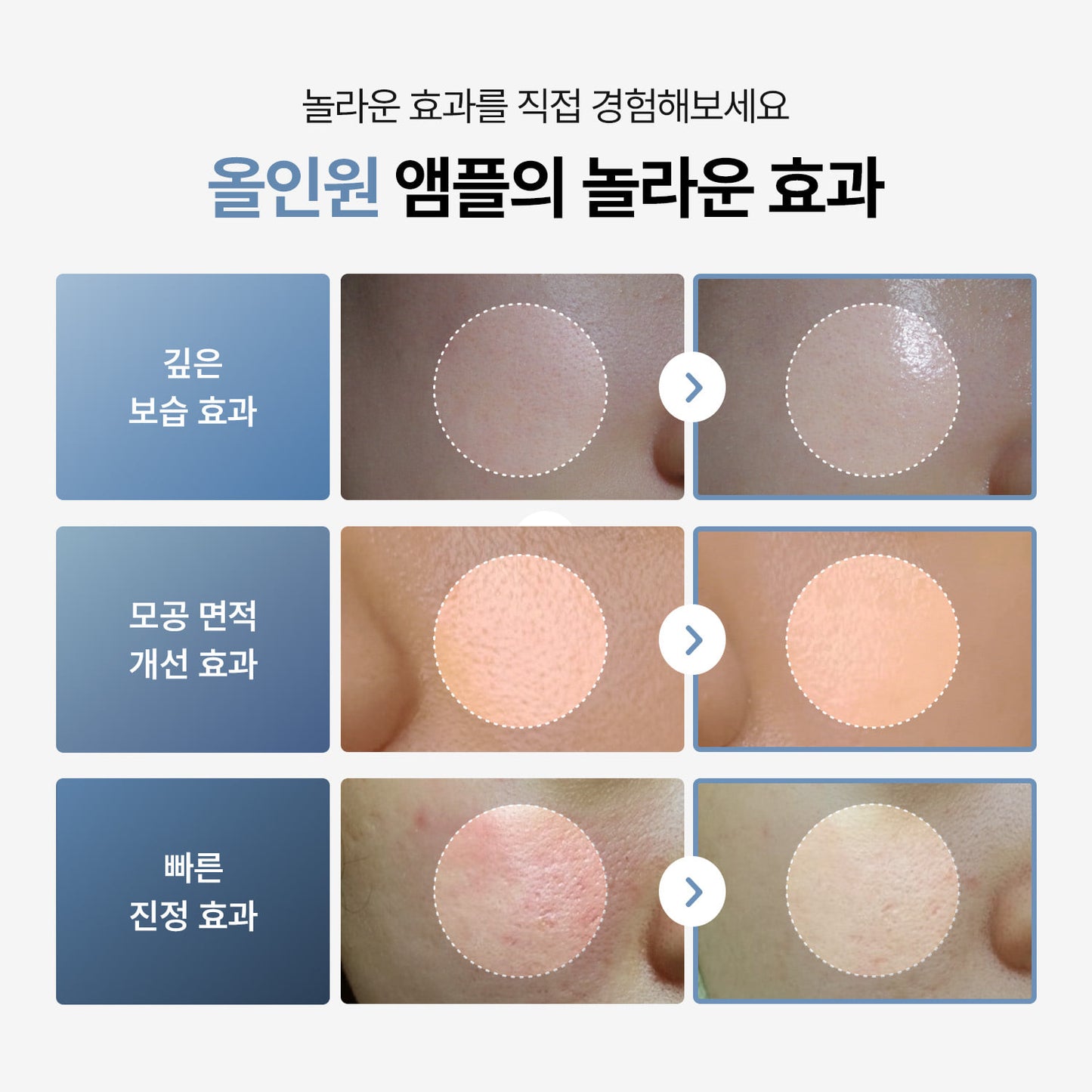 TODAY With Soft Moisture Camling Ampoule 100ml
