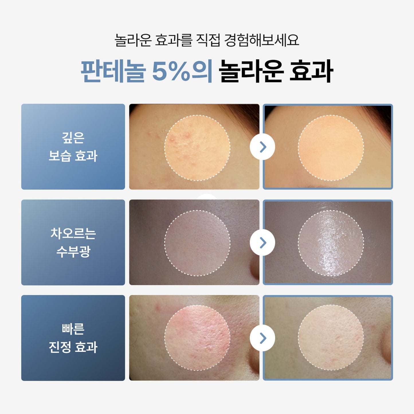 TODAY With Soft Moisture Panthenol Lotion 300ml