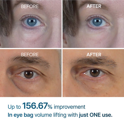 Dr.Melaxin Eyephalt Eyebag Cream 10g Set